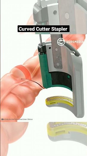 How a Curved Cutter Stapler Works: Cutting and Stapling Tissue in Surgery #medical #animation #learn