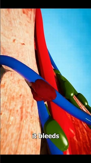 Vein Puncture! ( Explained) #facts #shorts #medical #science #health