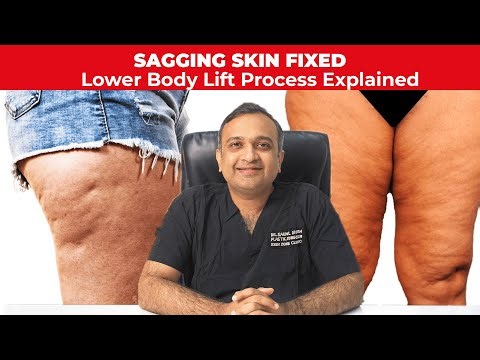 Struggling with loose, hanging skin in your lower body!