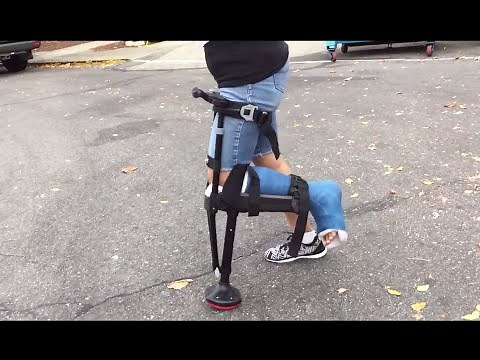 USING IWALK 2.0 AFTER AN ANKLE FRACTURE - EFFORTLESSLY PERFECTLY EVERY TIME !!!