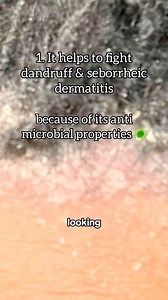 6.3K views · 45 reactions | ACV is a powerhouse of nutrients and benefits for your loc journey. This doesn’t even scratch the surface of it’s capabilities 爛 : @Alexwiththel0cs @퓜퓪퓷퓲曆~ on IG #locjourney #naturalhair #naturalproducts #locs #acv | FreeTheRoots | Facebook