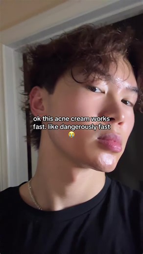 Effective Acne Cream That Works Fast