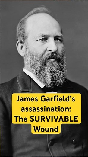 James Garfield Assassination: The SURVIVABLE Wound