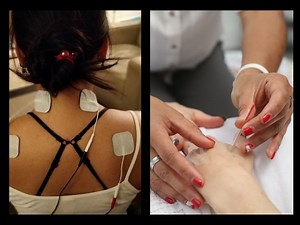TENS Unit vs. Dry Needling: What’s the Difference? - Optimize Health 365