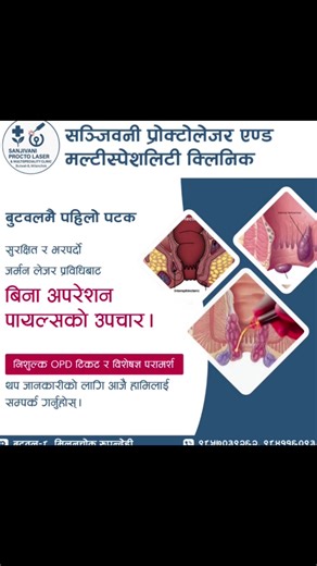 🌟 सञ्जीवनी प्रोक्टोलेजर एण्ड मल्टिस्पेशालिटी क्लिनिक 🌟 बुटवलको पहिलो र उत्कृष्ट दैनिक लेजर प्रोक्टोलोजी केन्द्र 🔹 हामीलाई किन रोज्ने? ✅ बुटवलकै पहिलो र एकमात्र दैनिक लेजर प्रोक्टोलोजी सेवा (शनिबारसहित बिहान ८:०० देखि बेलुका ६:०० सम्म) ✅ युरोपियन (जर्मन) लेजर मेसिन – सबैभन्दा अत्याधुनिक र उच्च शुद्धतासहितको परिणाम ✅ अनुभवी, प्रमाणित र प्रशिक्षित सर्जन तथा एनास्थेसियोलोजिस्टको टीम ✅ ५००० भन्दा बढी सफल अपरेशन – सुरक्षित र भरपर्दो सेवा ✅ बिना चिरा, बिना टाँका – पिडारहित र छिटो निको हुने उपचार ✅ अ