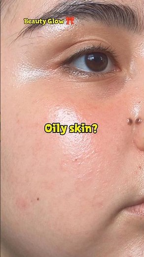 Best face mask for oily skin, acne, open pores 🎀#skincare #glowup #shorts