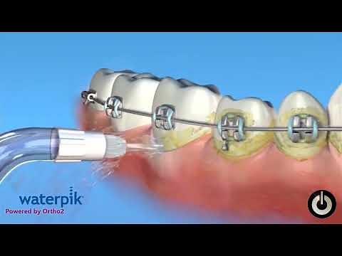 Say Goodbye to Braces Woes: Learn How to Use Water Floss Properly