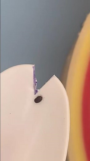 DIY Spoon Tick Removal Tool 😷 #goodtoknow #survival #lifehacks #surgeonlife #vet #medicine #hacks