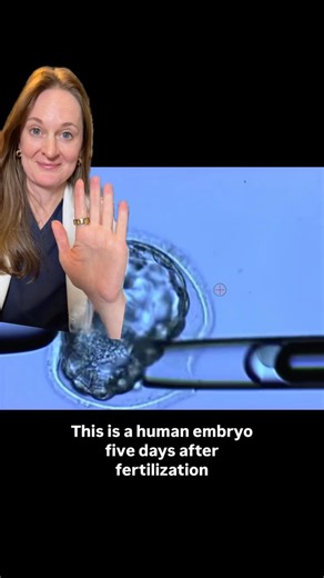 Watch an embryo biopsy!
