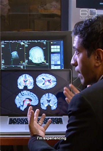 Dr. Sanjay Gupta climbed into an MRI scanner to see how his brain responded when he drank a sugary soda. In 2012, neuroscientist Eric Stice said studies showed frequent soda and sweets consumption could build tolerance, similar to drugs, meaning the more you ate, the less reward you felt and the more you wanted. #sugar #health #diet #addiction #mri
