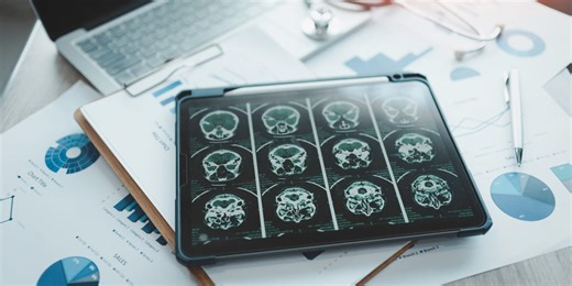 The New Alzheimer’s Disease Test You Should Know About