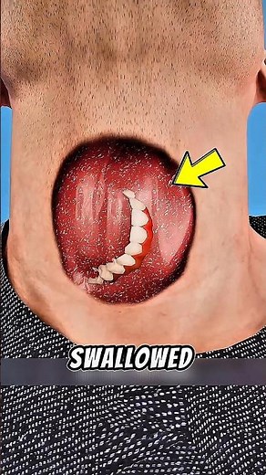 Swallowed a Tooth?! Here’s What Happens Next 😳