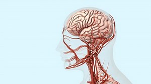 Atherosclerotic cardiovascular disease and stroke