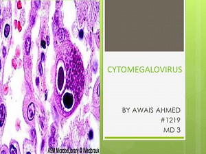 CYTOMEGALOVIRUS - SlideServe