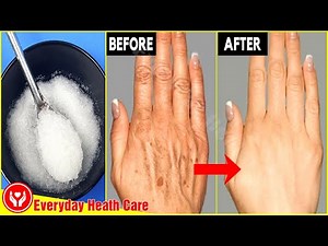 Apply This To Make Your Hands Look 5 Years Younger And Get Beautiful Soft Hands