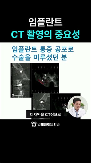 임플란트 치료, CT 촬영이 중요한 이유는?