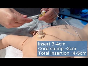 How to Place an Umbilical Venous Catheter - UVC