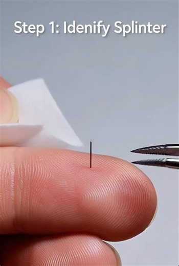 Splinter Removal from Fingers #ai #finger #splinter #bandage #aishorts #aireels #aivideo #foryou