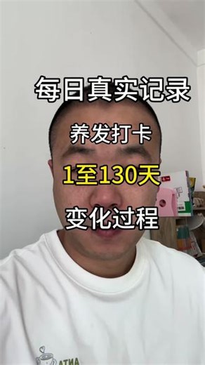 每日真实记录 86大叔，拯救地中海发型，养发打卡，1至130天的漫长变化过程#发缝宽 #养发分享 #脂溢性脱发 #养发日记 #真实记录