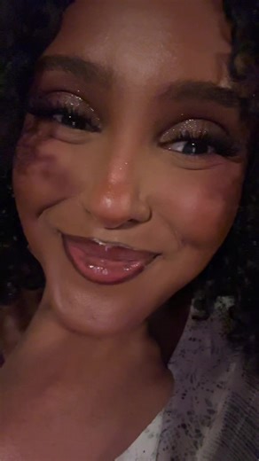 Embracing My Smile Lines with Confidence