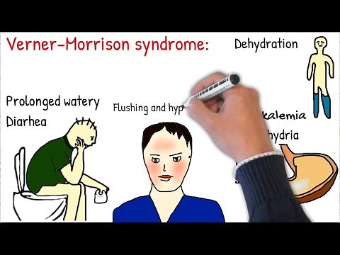 Vipoma - symptoms, causes, treatment. made simple.