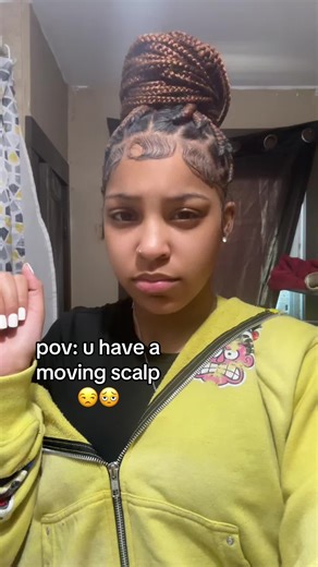chill in my edges i’m bouta wash nd redo them ! #movingscalp #hair #realatable #real #viral
