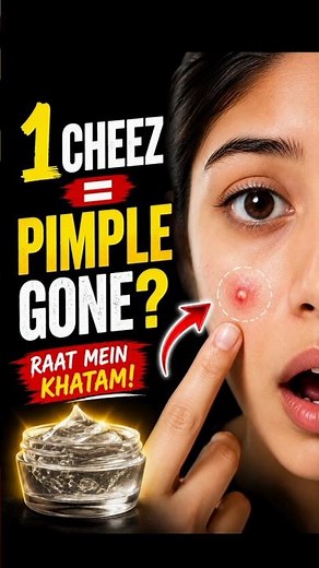 How to Remove Pimples Fast Naturally | Best Acne Treatment | Clear Skin Tips