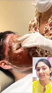 1.5M views · 10K reactions | Viral Face Whitening Mask At Home/Skin Whitening Home Remedies #shorts #skincare #youtubeshorts #reelsvideoシ #reelsfypシ #reelschallenge #reelsfb #reelsviral #fypシ | Anamika Barai | Facebook
