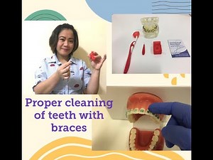 How to clean teeth with braces? ( Paano ang tamang paraan ng paglilinis ng ngipin na my brace?)