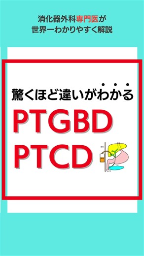 - 略語解説- PTGBD percutaneous transhepatic gallbladder drainage 経皮経肝胆囊ドレナージ PTCD percutaneous transhepatic cholangio drainage 経皮経肝胆道ドレナージ ERBD endoscopic retrograde biliary drainege 内視鏡的逆行性胆道ドレナージ術 #看護師 #現役看護師 #看護師あるある #看護師の日常 #看護師の勉強垢 #医師 #医者 #看護師一年目#新人ナース#新人看護師#胆嚢炎#胆管炎#外科医 #外科