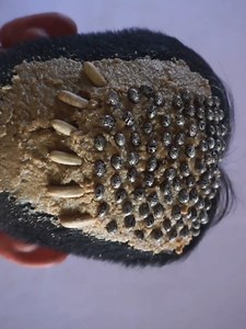 Dandruff the satisfying removal #DandruffScratching #ItchyDryScalp #HugeFlakes #Dandruff #dandrufftreatment #satisfying #dandruffremoval Disclaimer: Videos do not show original Dandruff,they are used for education purpose. Thank You,,,. | Hit's