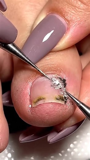 Satisfying Nail Cleaning ASMR for Stress Relief