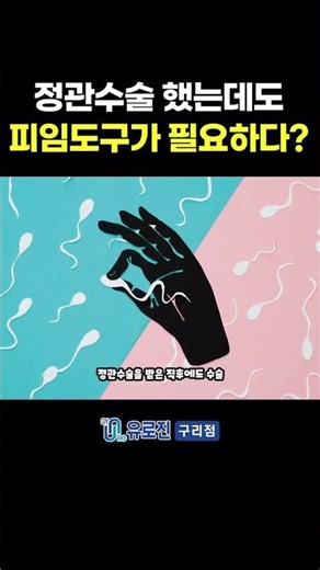 정관수술 후에도 피임하는 남자? 이걸 모르면 임신!