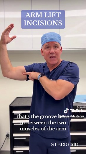 #armlift #armlifting #armliftsurgery #incisions