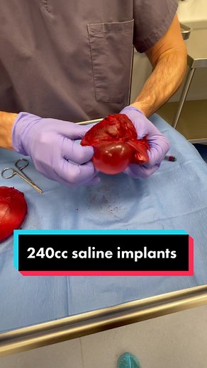 I remove the capsule to these 240cc saline implants #surgerytiktok #bii #plasticsurgery #explant #implant #breastimplantilless #implants #surgery