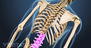 How Your Walking Posture Affects Your Sciatic Nerve