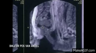 Amazing MRI scan video captures couple having sex (2014) on Make a GIF