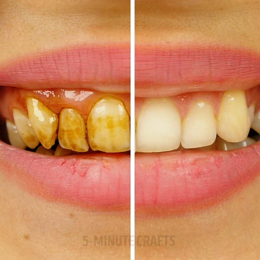 6.3M views · 24K reactions | Baking Soda Hacks: | 5-Minute Crafts GIRLY | Facebook