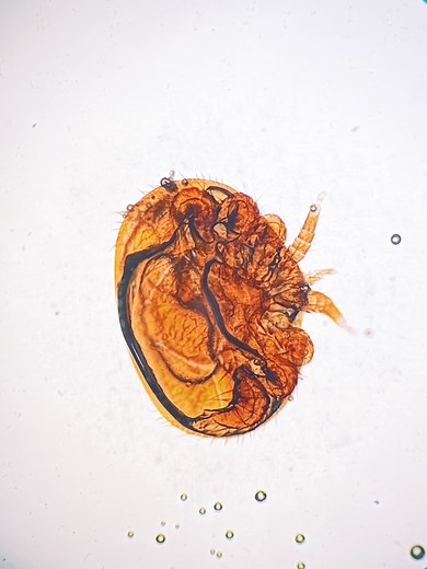 I was dissecting some drone brood when I found them… Varroa destructor—the vampiric parasites of the hive. 🕷️ I slipped a few onto a microscope slide, and they looked like they were dancing. But the truth? It was just the gel. Nothing like a bit of science to ruin the illusion.🖤 Creepy Mite Facts:• They prefer drone brood—it gives them more time to reproduce• Each female mite can lay up to 6 eggs in a single cell• They feed on fat bodies, weakening the bee’s immune system• They’re vectors for