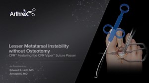 Lesser Metatarsal Instability Without Osteotomy CPR™ Featuring the CPR Viper™ Suture Passer