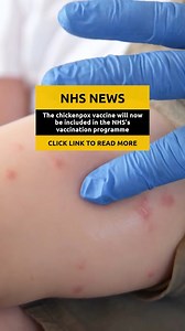 The chickenpox vaccine will now be included in the NHS's vaccination programme - meaning hundreds of thousands of young children will be protected against getting the infection 💉 Young children will be offered protection against varicella as part of their routine childhood vaccinations from today. #manchestereveningnews #chickenpox #nhs #vaccine | Manchester Evening News