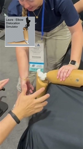 Elbow Dislocation? Solo technique fail then ask for help! She got it.