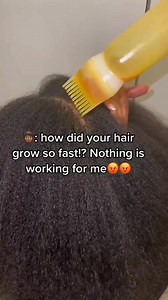 203K views · 674 reactions | Consistency is tge key! Use this hairoil to grow your hair #4chair #hairgrowth #hairoil #rosemary #cloves #naturalhair #hairgrowth #4chair | Lifewitqueenp | Facebook