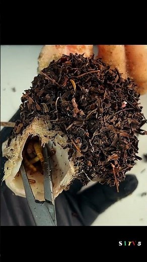 Wow ~ toenails are rotten, under the nail fungus n2 1055