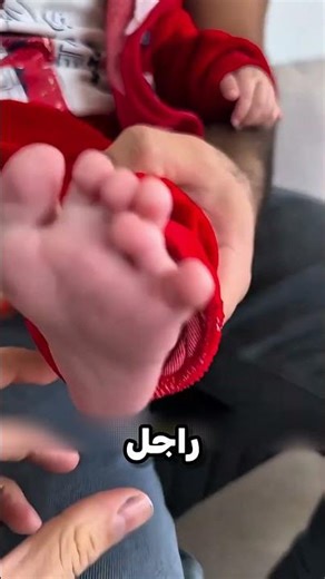 ابني عندو 6 اصابع 😲