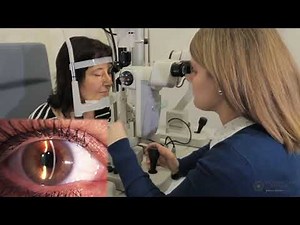 Van Herick Method in Evaluation of the Anterior Chamber Angle