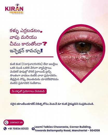 Red Eyes, Swelling & Eye Discharge? | Eye Infection Warning Signs | Conjunctivitis Treatment