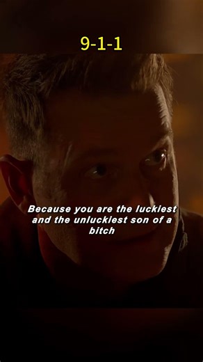 There's a steel rod stuck in his head, yet he's still alive.