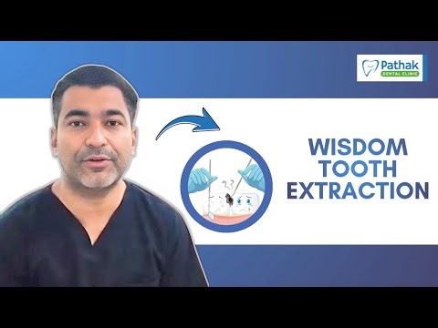 Wisdom Tooth Extraction Truth | Pain, Swelling, Healing & Cost | Best Dentist in Pune