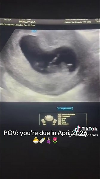 I can't wait to meet you! Who else has a spring baby on the way? 🥹✨🪽🌷 #10weekspregnant #bumpjourney #pregancy #embarazofeliz